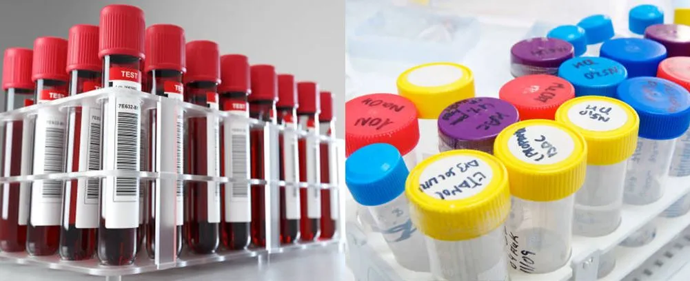 plastic test tube rack for 50ml tubes applications